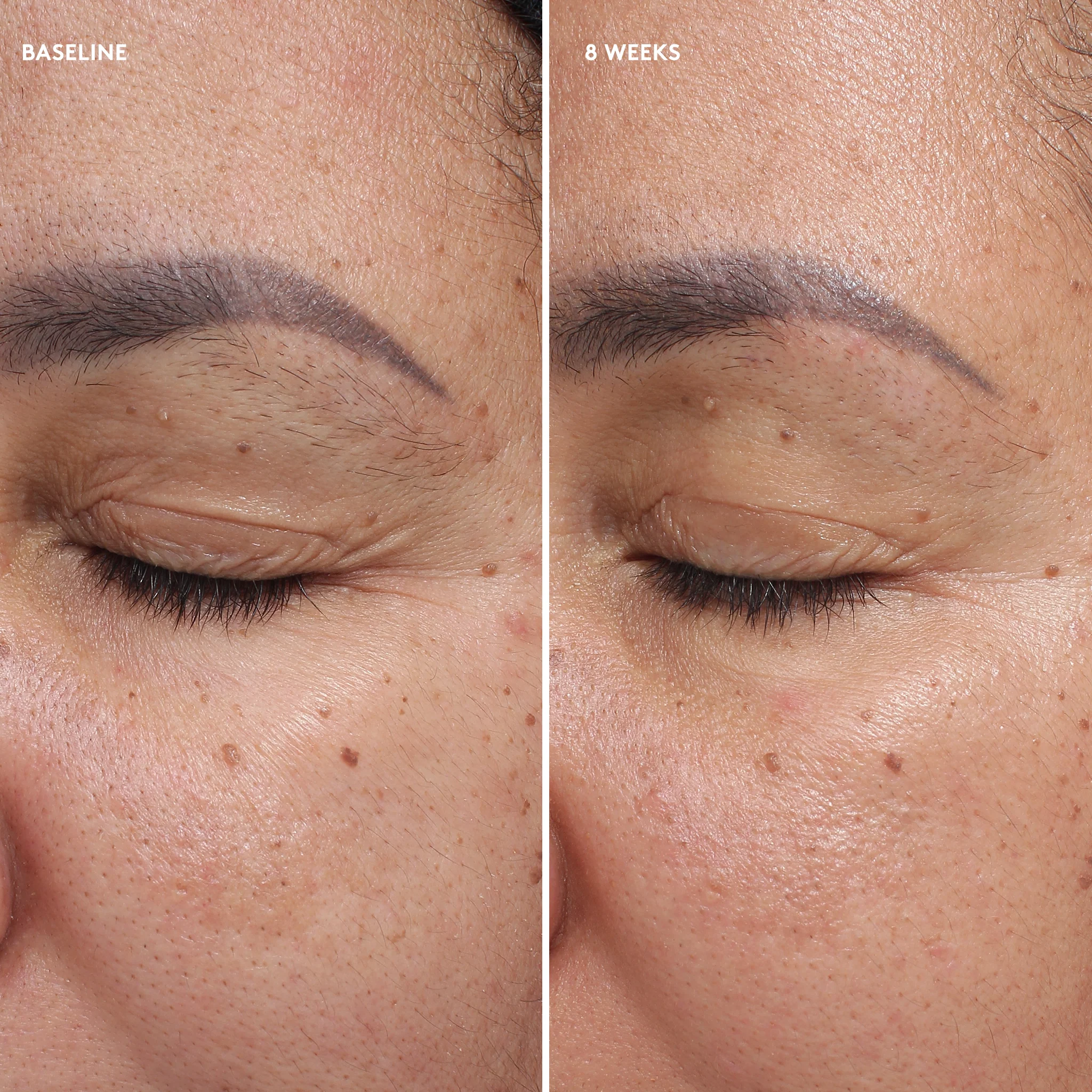 Total Eye® Firm & Repair Cream - Image 6