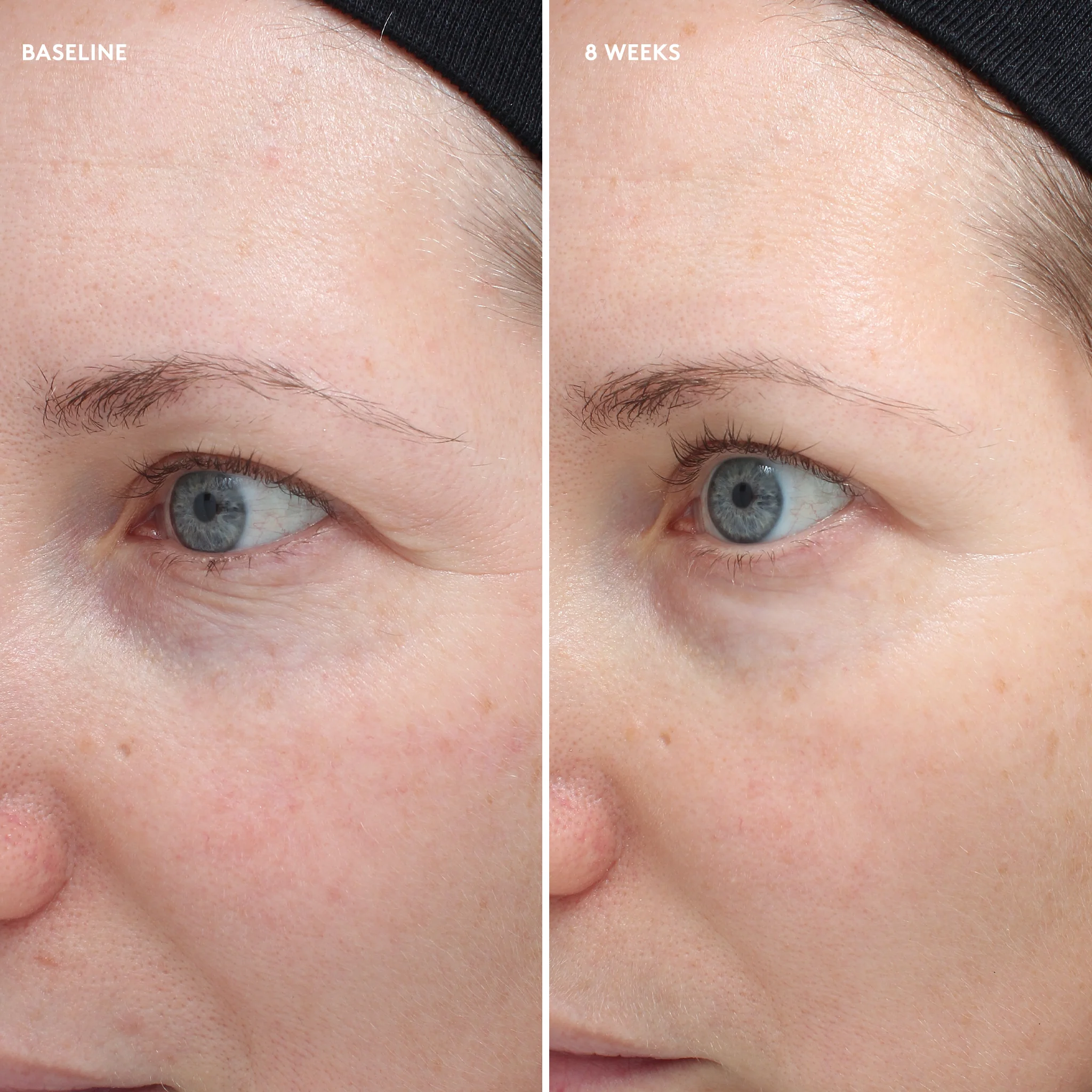 Total Eye® Firm & Repair Cream - Image 7